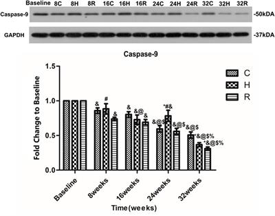 Effect of 32-Weeks High-Intensity Interval Training and Resistance Training on Delaying Sarcopenia: Focus on Endogenous Apoptosis